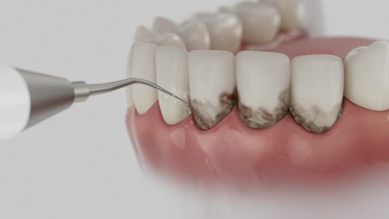 Trusted Teeth Cleaning And Checkup service in Bowdon, GA - Dentist Open Now